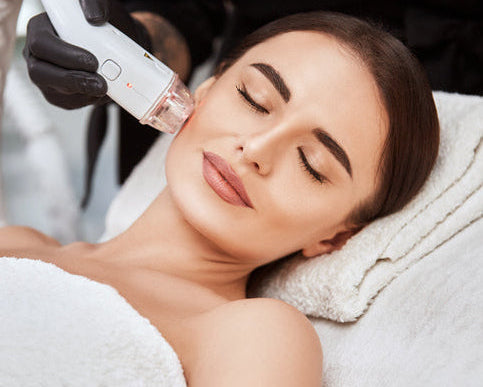 RF Skin Needling Innaloo Perth