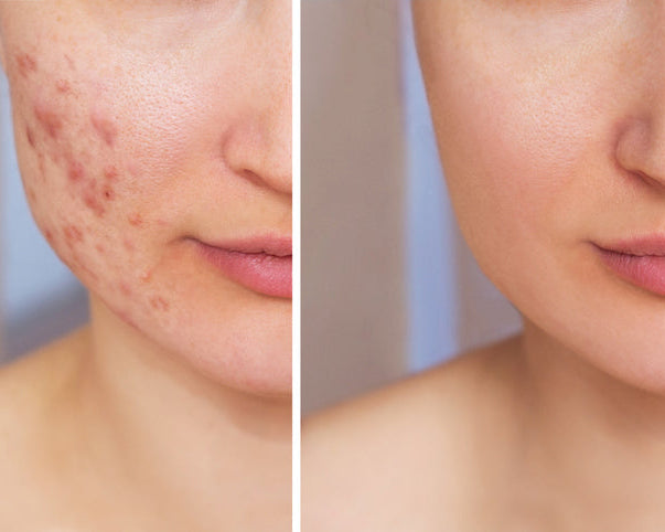 VitalCell Reset (MESO-TOX)