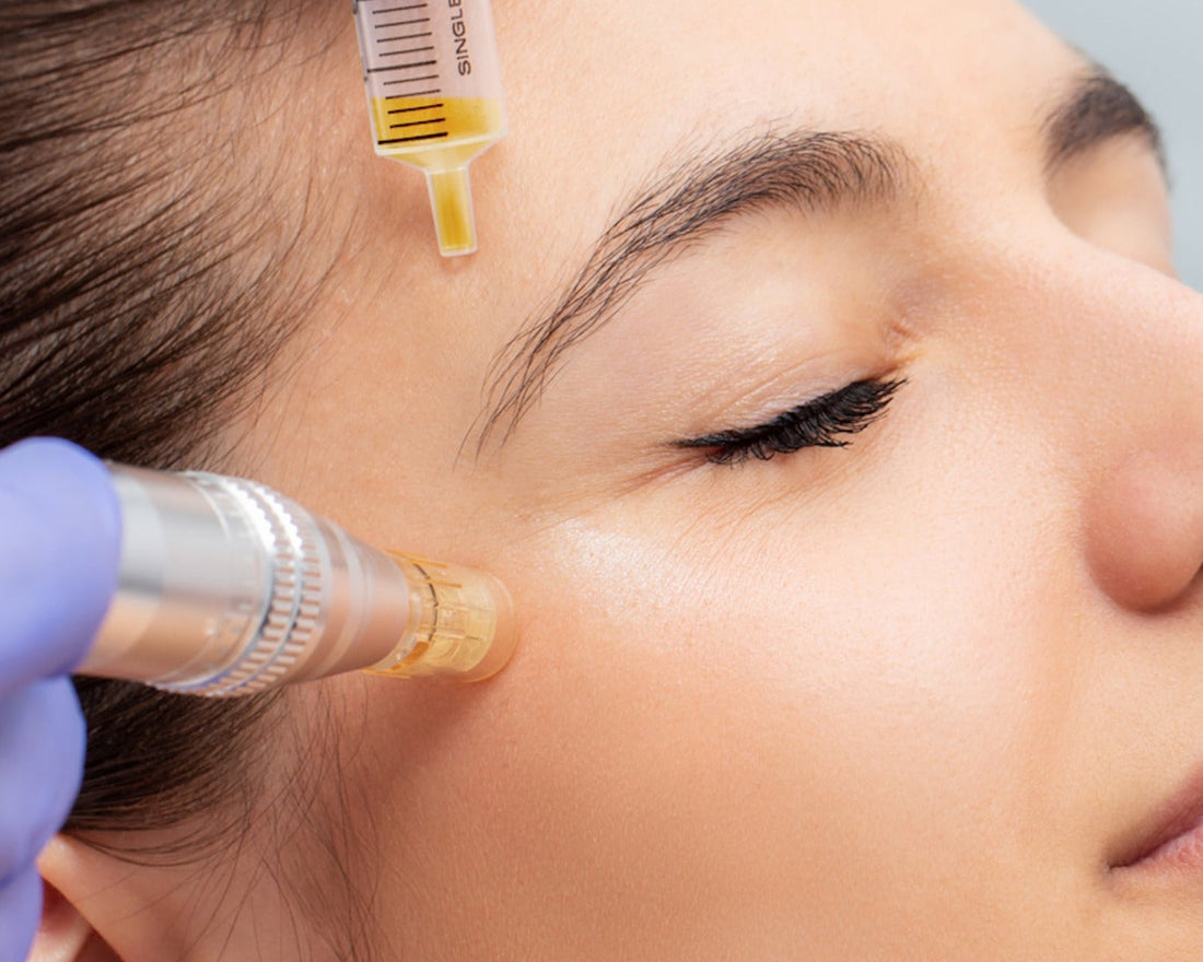 Skin needling treatment
